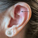 Q-tip in the cave anxiety trick, Ear Shenmen, Austin, TX