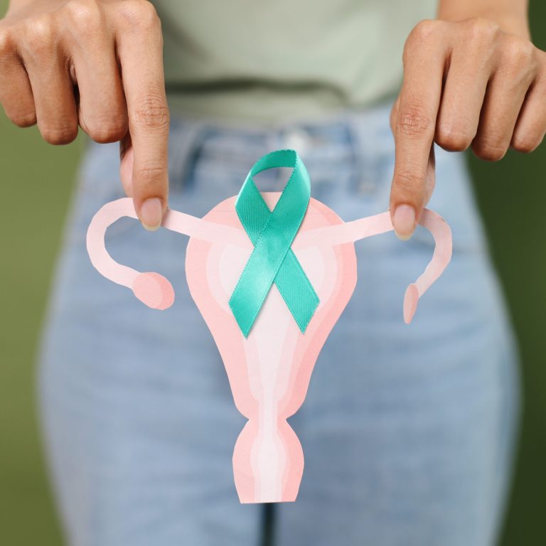 Acupuncture for PCOS fertility